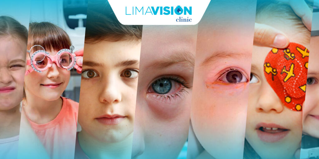 Problemas Oculares Niños